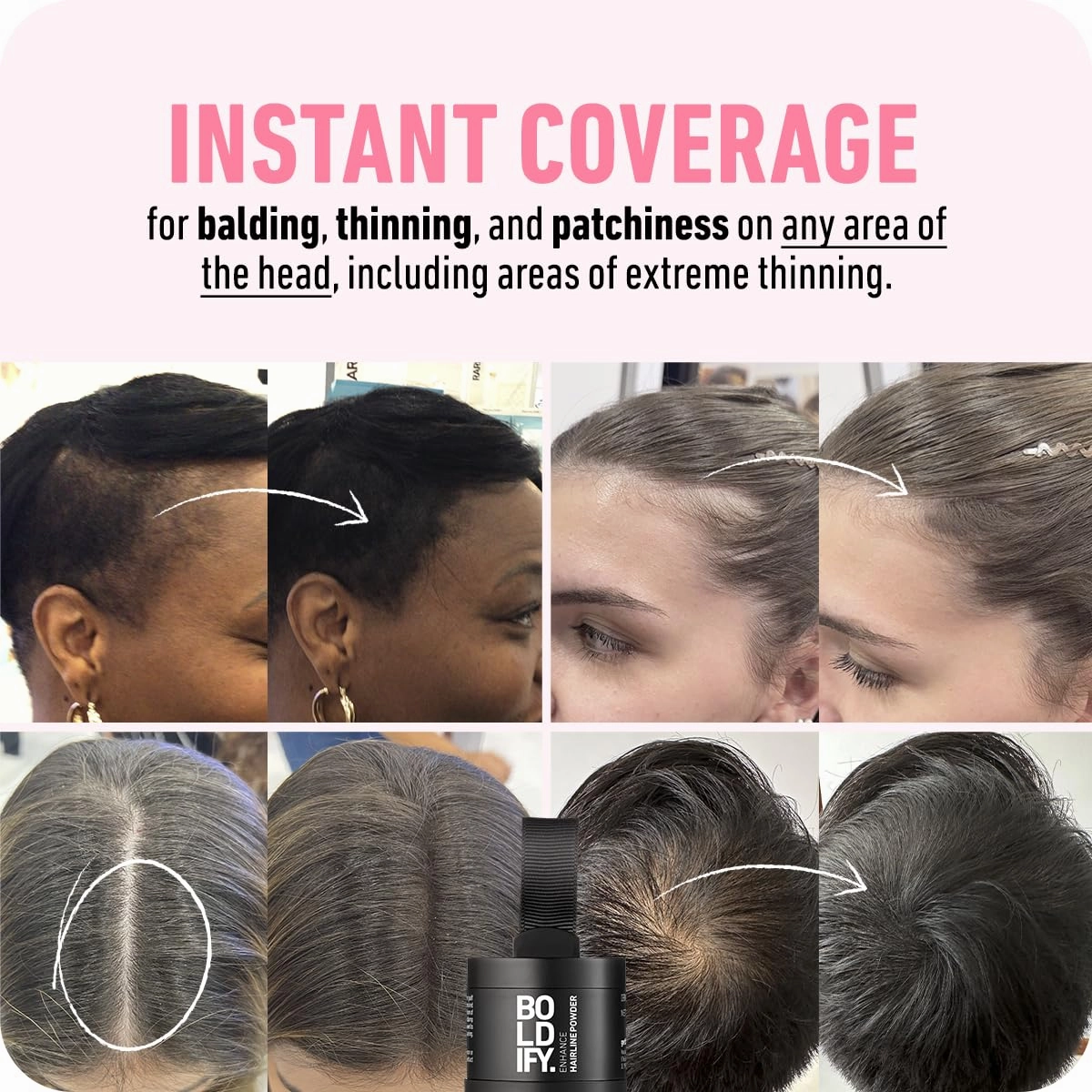 Boldify Hairline Powder   Hair Fiber: bundle that Instantly Conceals Hair Loss Hair Powder for Thinning Hair, Root Cover Up (Black)