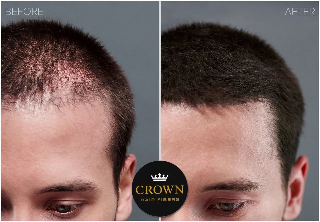 CROWN Hair Building Fibers (28g) - Instantly Cover Fine & Thinning Hair for a Thicker, Fuller Look - A Natural Keratin Concealer - 13 Shades for Men & Women - Medium Brown