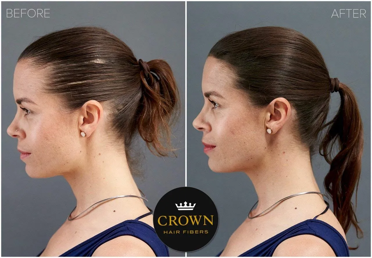 CROWN Hair Building Fibers (28g) - Instantly Cover Fine & Thinning Hair for a Thicker, Fuller Look - A Natural Keratin Concealer - 13 Shades for Men & Women - Medium Brown
