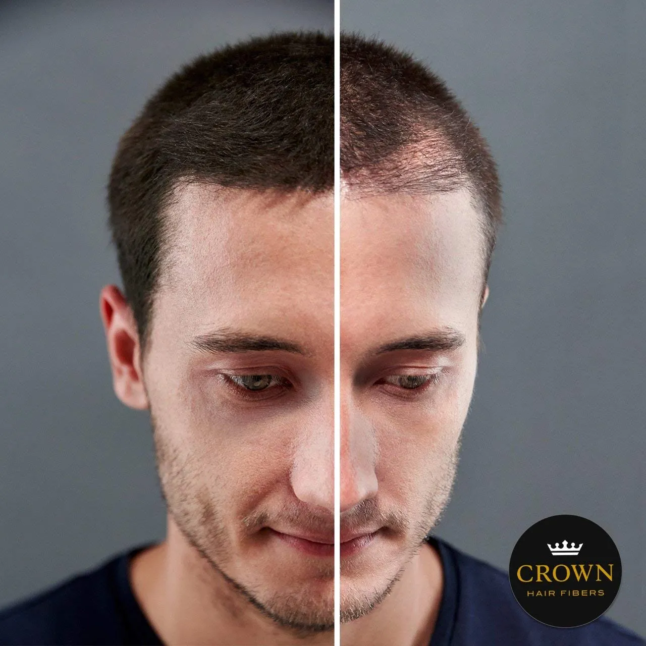 CROWN Hair Building Fibers (28g) - Instantly Cover Fine & Thinning Hair for a Thicker, Fuller Look - A Natural Keratin Concealer - 13 Shades for Men & Women - Medium Brown