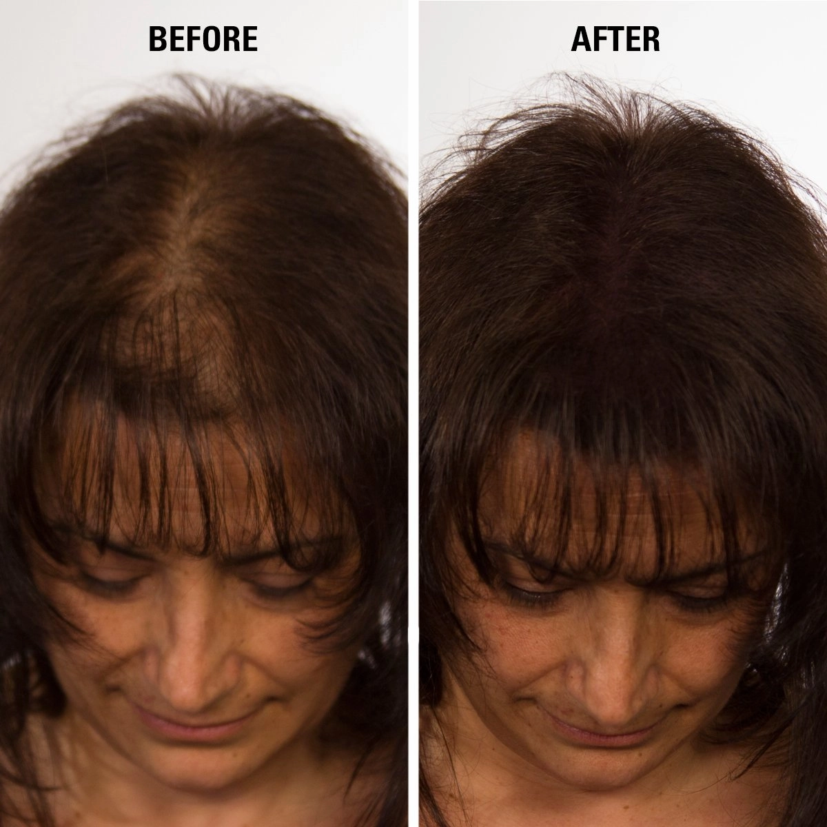 ECLIPSE Hair Fibers Medium Brown for Thinning Hair for Women & Men to Conceal Hair Loss in 15 Seconds - 100% Undetectable Hair Building Fibers, 60g