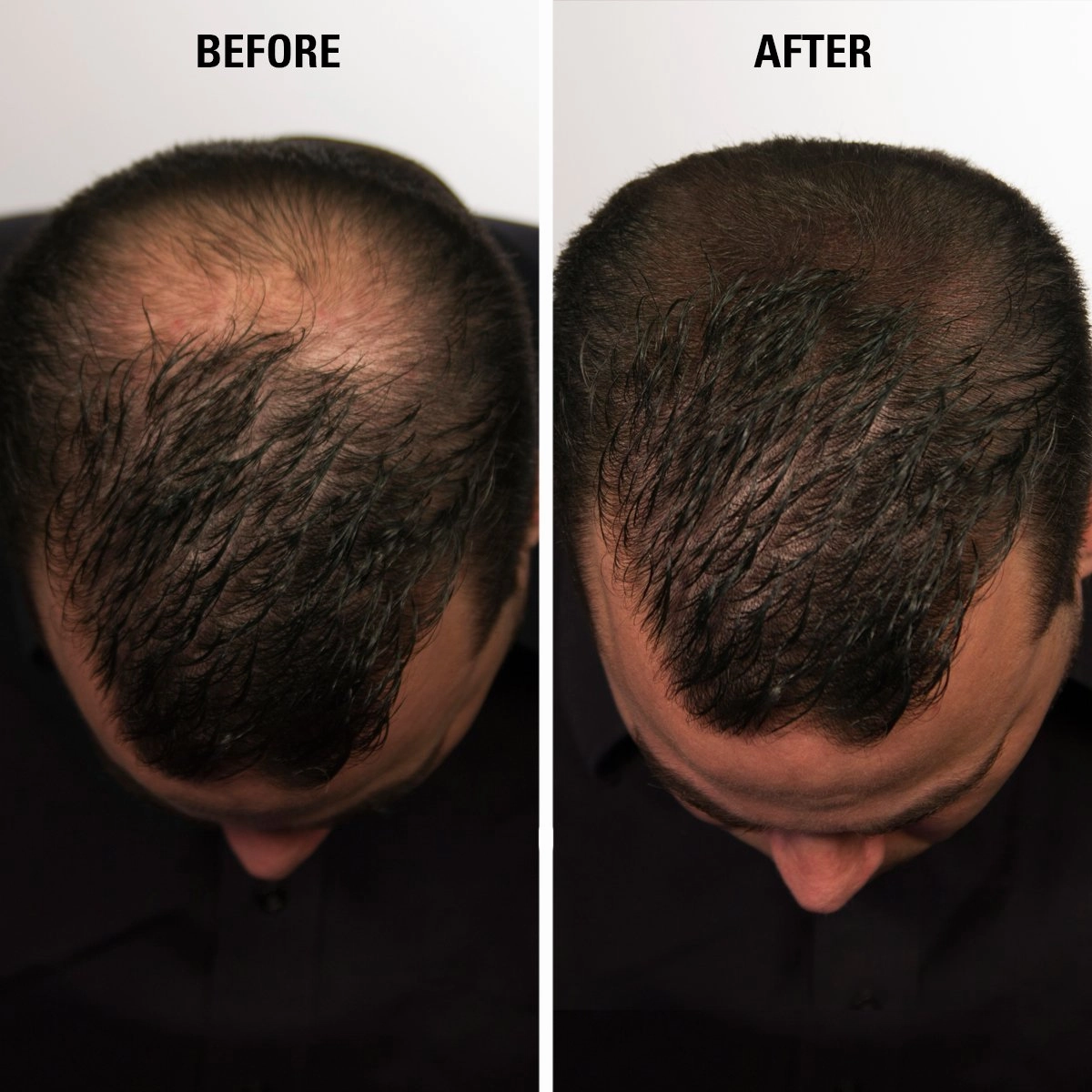 Hair Fibers Dark Brown for Thinning Hair for Women & Men - 100% Undetectable Hair Building Fiber Powder - Conceal Hair Loss in 15 Seconds, 60g