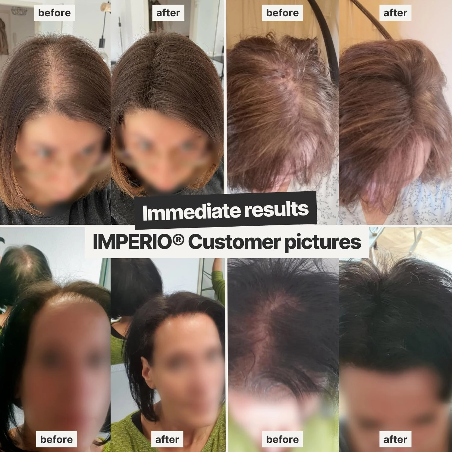 IMPERIO Hair Building Fibers for Thinning Hair - 26g Premium Hair Fibers for Women & Men in Hairdresser Quality - Hair thickening in less than 20 seconds (Black)
