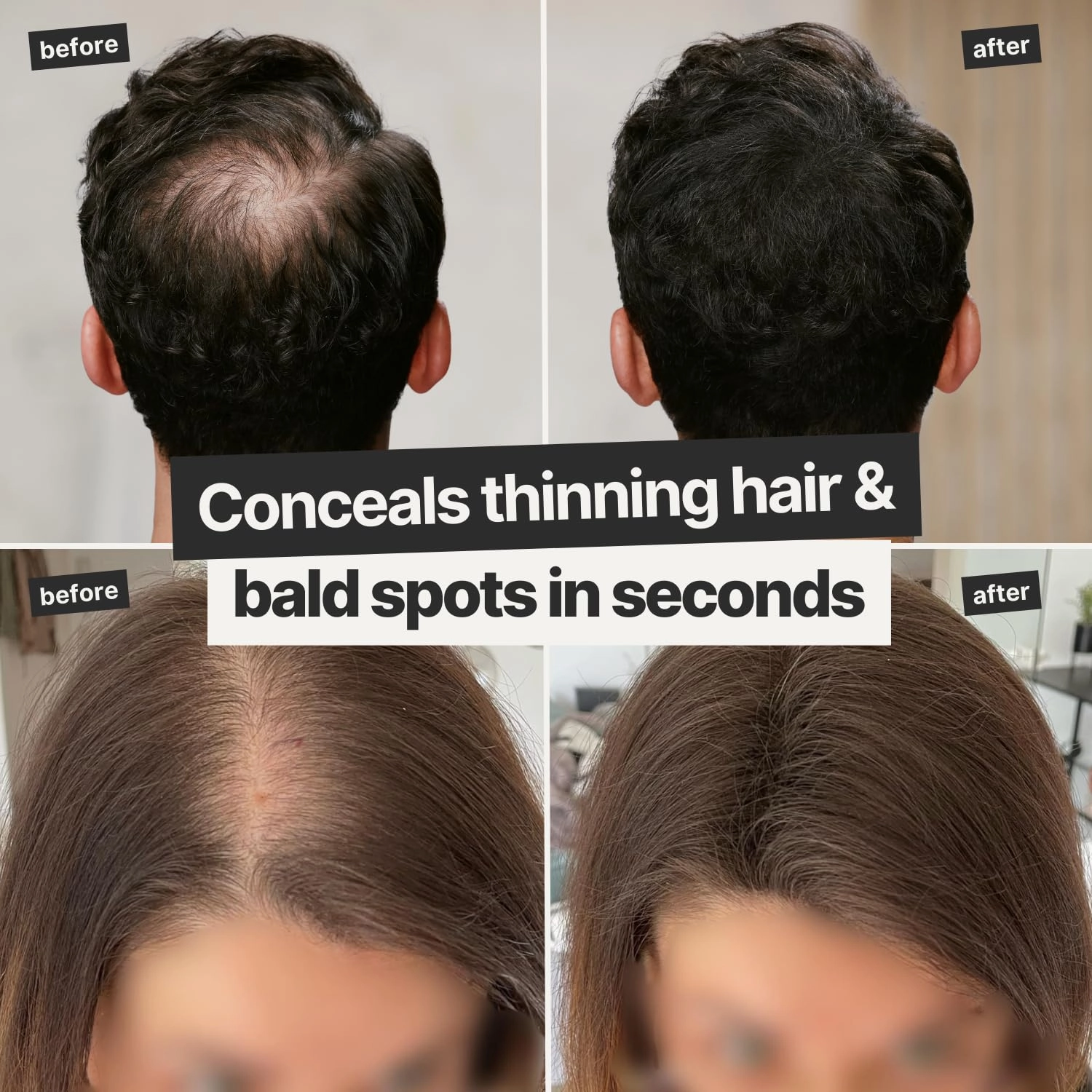 IMPERIO Hair Building Fibers for Thinning Hair - 26g Premium Hair Fibers for Women & Men in Hairdresser Quality - Hair thickening in less than 20 seconds (Black)