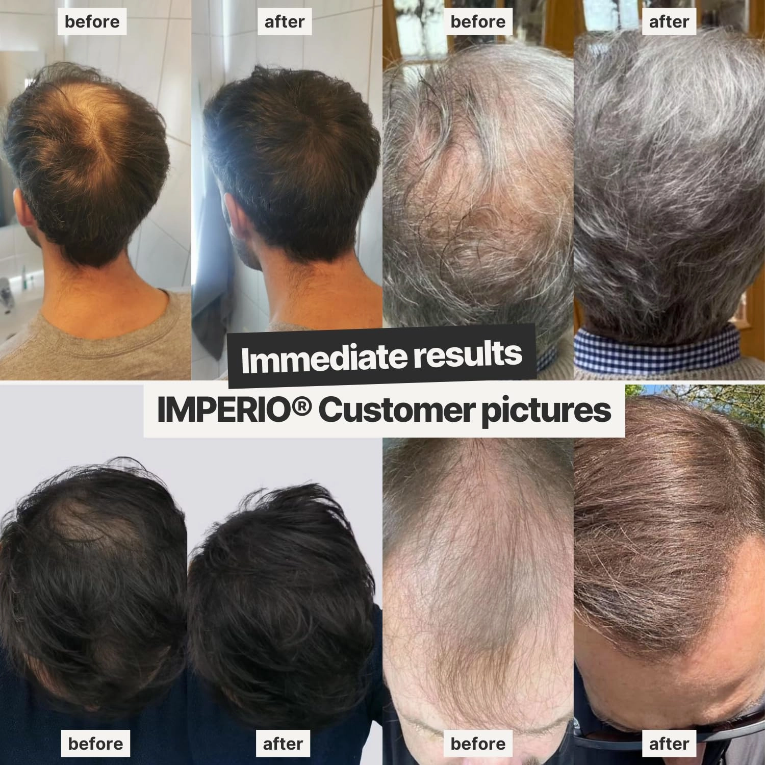 IMPERIO Hair Building Fibers for Thinning Hair - 26g Premium Hair Fibers for Women & Men in Hairdresser Quality - Hair thickening in less than 20 seconds (Black)