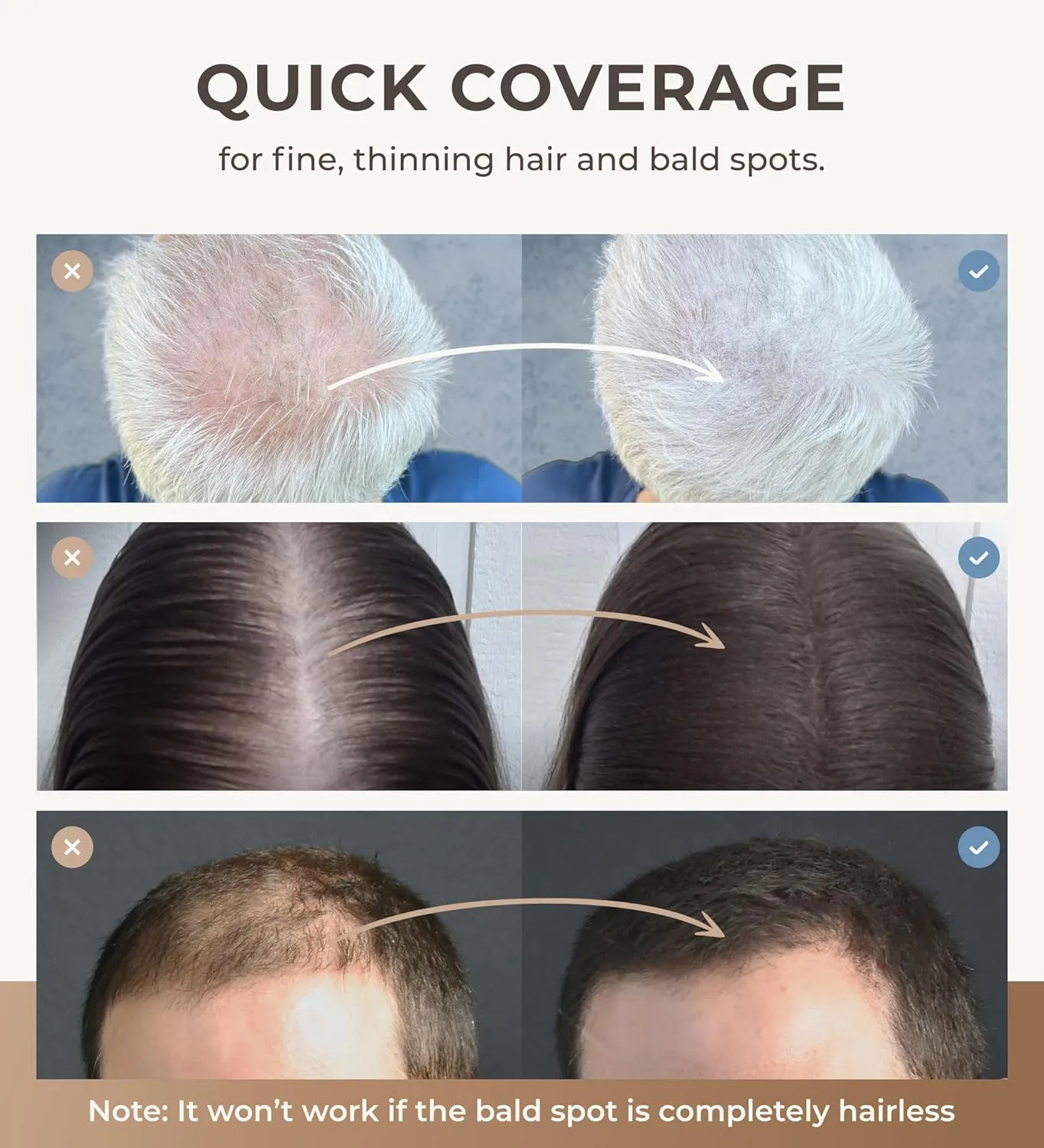 Keratin Hair Fibers for Men & Women - Fill In Fine or Thinning Hair, Instantly Thicker, Fuller Looking Hair (Black, 15g)