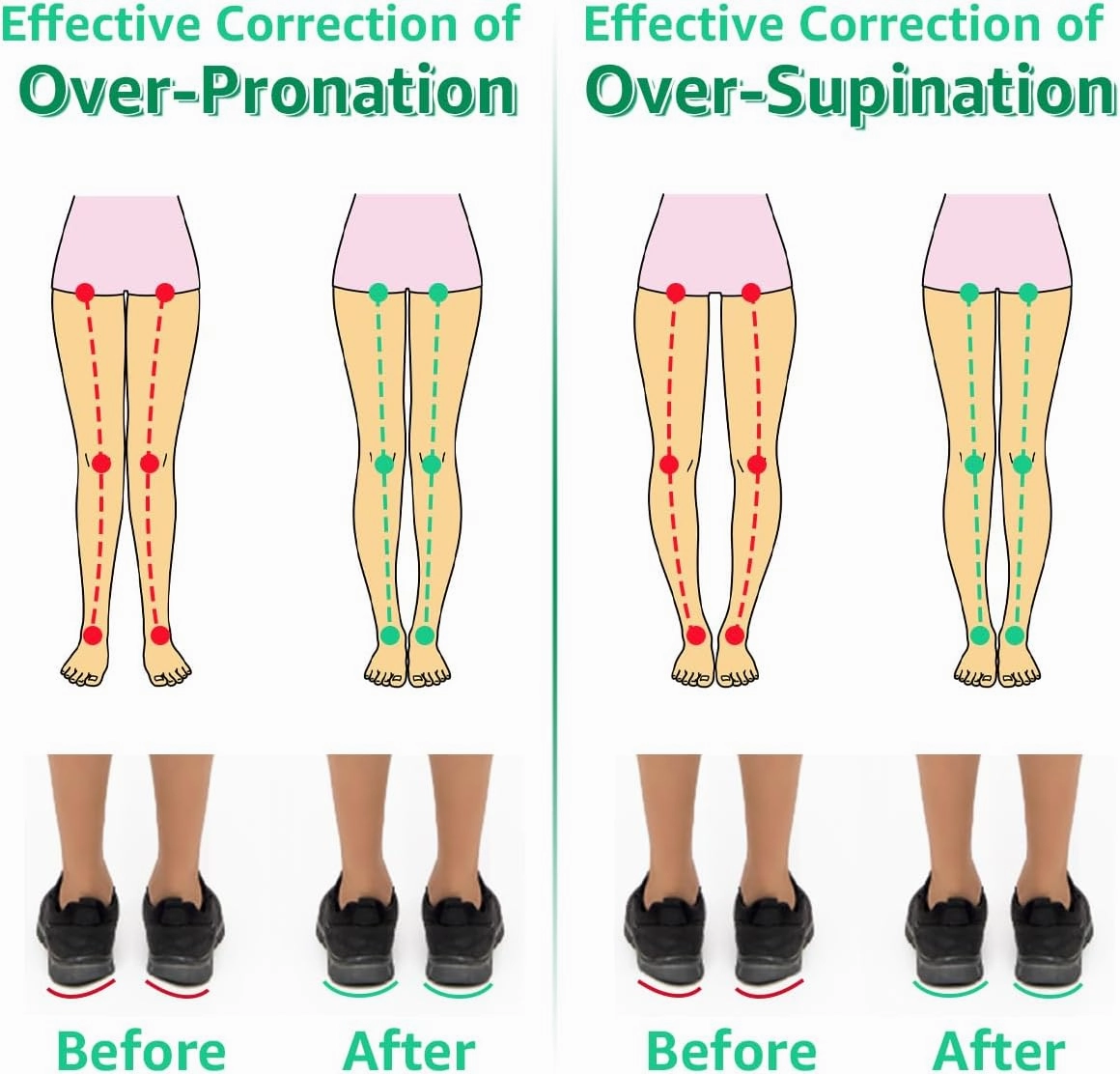 Skyfoot 3 Layers Adjustable Heel Wedge Inserts for Supination & Pronation Correction, Adhesive Medial & Lateral Heel Insoles for Bow Legs, Knee Pain, Foot Alignment (S: W 4-6.5, M 5-6.5, ClearBlack)
